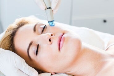 HydraFacial™| Akne